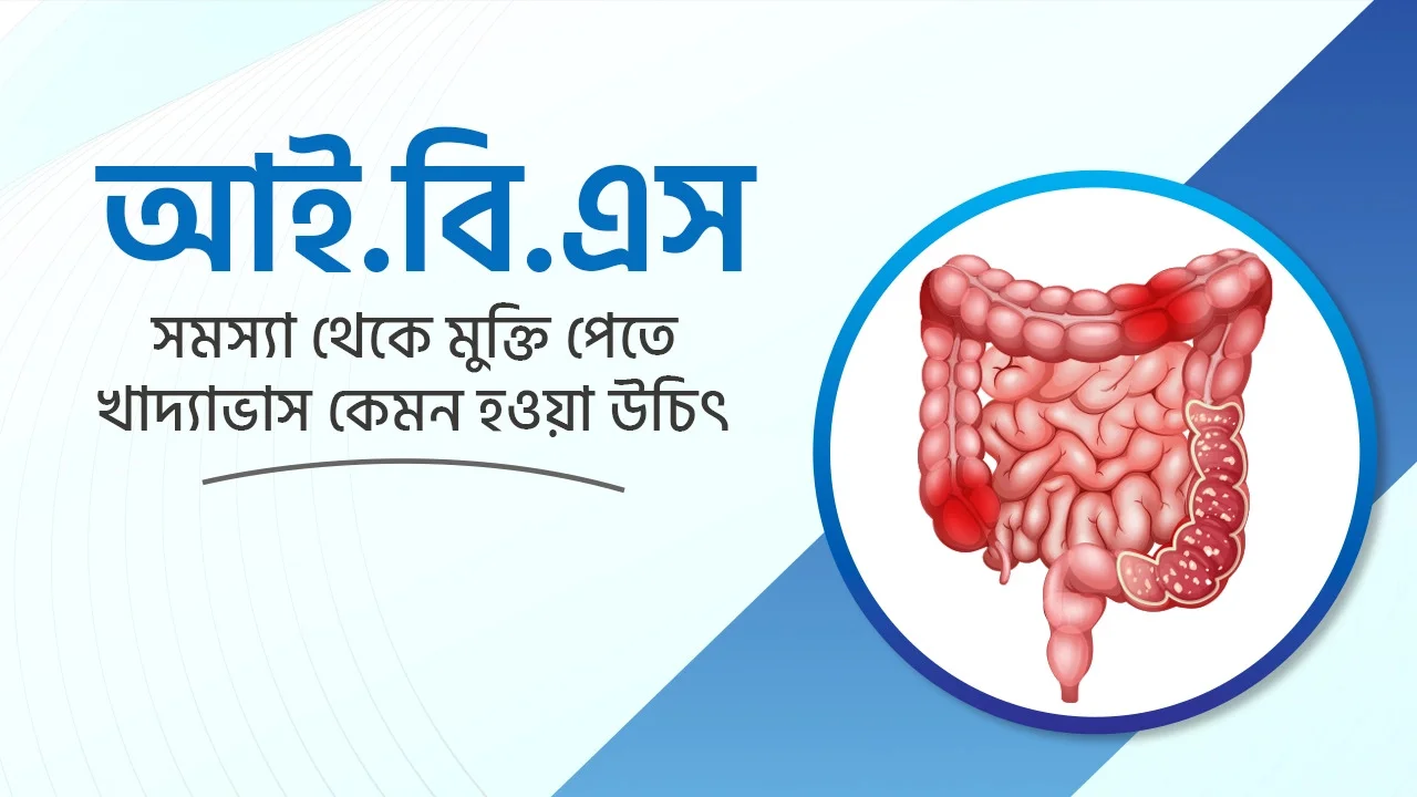 আইবিএস (IBS) সমস্যা থেকে প্রাকৃতিক উপায়ে মুক্তির উপায়