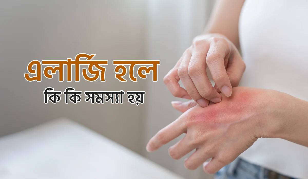এলার্জি হলে কি সমস্যা হয়