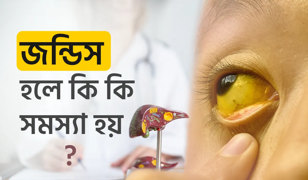 জন্ডিস হলে কি কি সমস্যা হয়, জন্ডিস প্রতিরোধে প্রাকৃতিক খাদ্যাভ্যাস