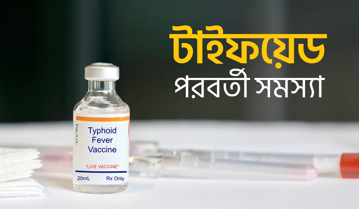 টাইফয়েড পরবর্তী সমস্যা, জেনে নিন প্রতিরোধের উপায়