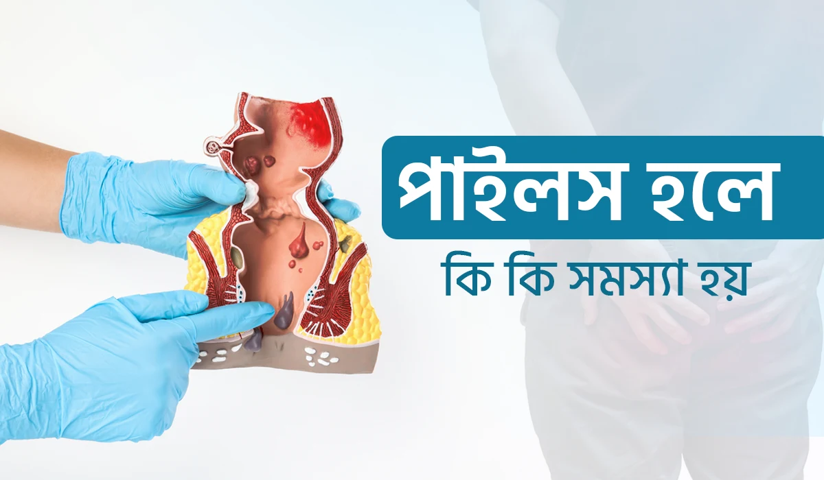 পাইলস হলে কি কি সমস্যা হয়