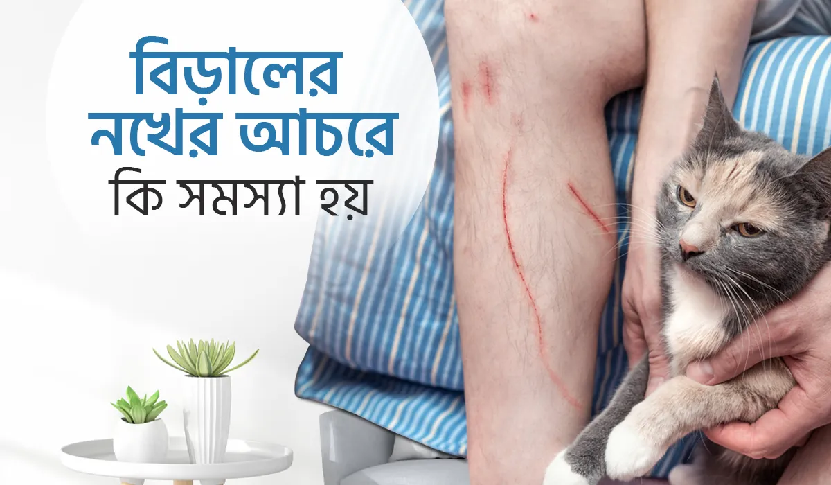 বিড়ালের নখের আঁচড়ে কি কি সমস্যা হয়?