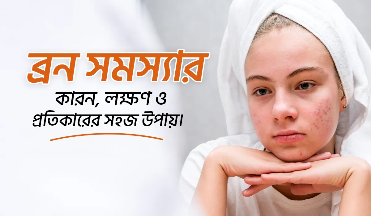 ব্রন সমস্যার কারন, লক্ষণ ও প্রতিকারের সহজ উপায়